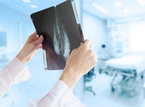Detection cancer du sein