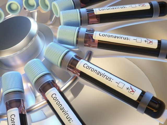 Vaccin COVID-19 AP-HP Pasteur Sanofi