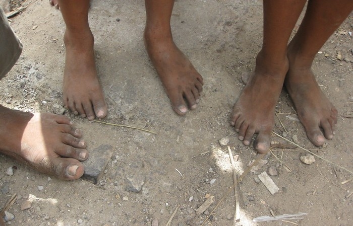 Pieds d'enfants qui travailent en Inde